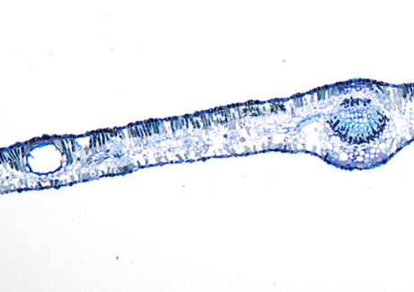ユーカリラディア―タ