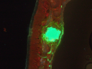 ユーカリグロブルス